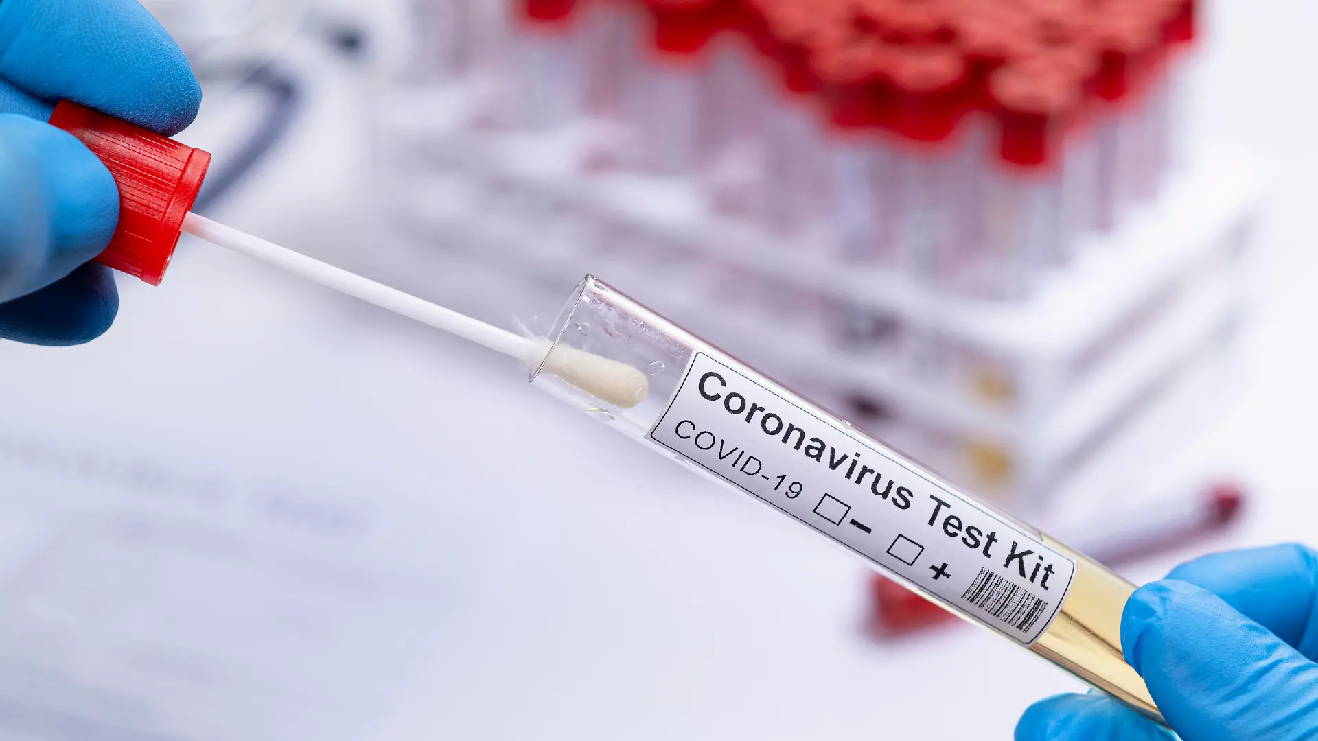 Coronatest