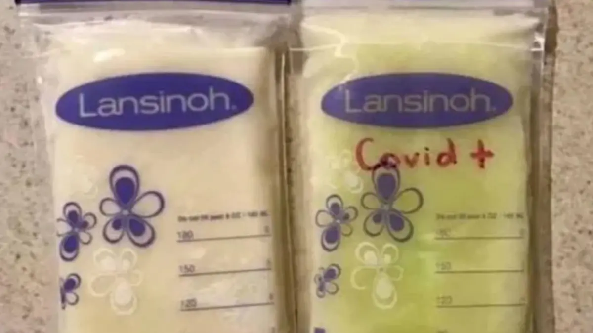 Muttermilch von Anna vor und nach Corona-Erkrankung