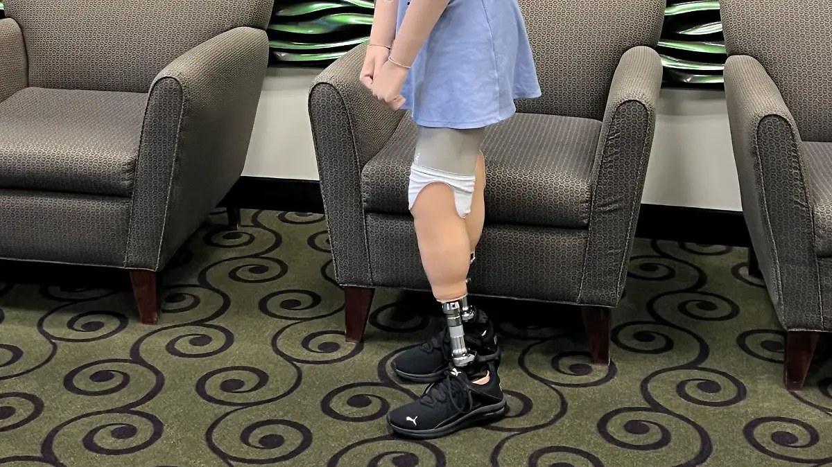 PIC FROM Kennedy News and Media (PICTURED: EVELYN DAVIS (22) FROM TYLER, TEXAS, US, IN FEBRUARY 2023 RECEIVING HER NEW LEG AND HAND PROSTHETICS) An aspiring model claims she was forced to have all four limbs amputated after contracting Legionnaires' disease 'from a concert's MIST MACHINE'. Evelyn Davis said she attended a music concert in June and a few days later began feeling extremely tired and had a high temperature and fever. But when the construction company admin assistant's condition deteriorated the next day, she was rushed to hospital and was diagnosed with sepsis and pneumonia. DISCLAIMER: While Kennedy News and Media uses its best endeavours to establish the copyright and authenticity of all pictures supplied, it accepts no liability for any damage, loss or legal action caused by the use of images supplied and the publication of images is solely at your discretion. SEE KENNEDY NEWS COPY - 0161 697 4266