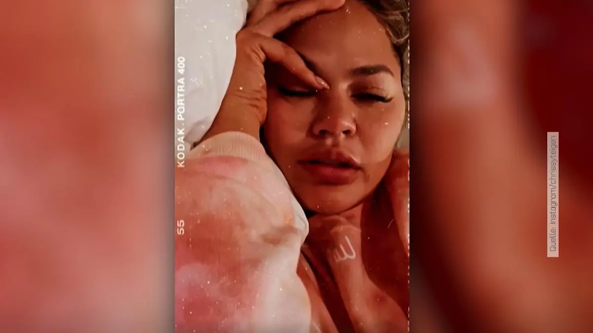 Chrissy Teigen erholt sich von Endometriose-OP Sie fühlt noch Tritte