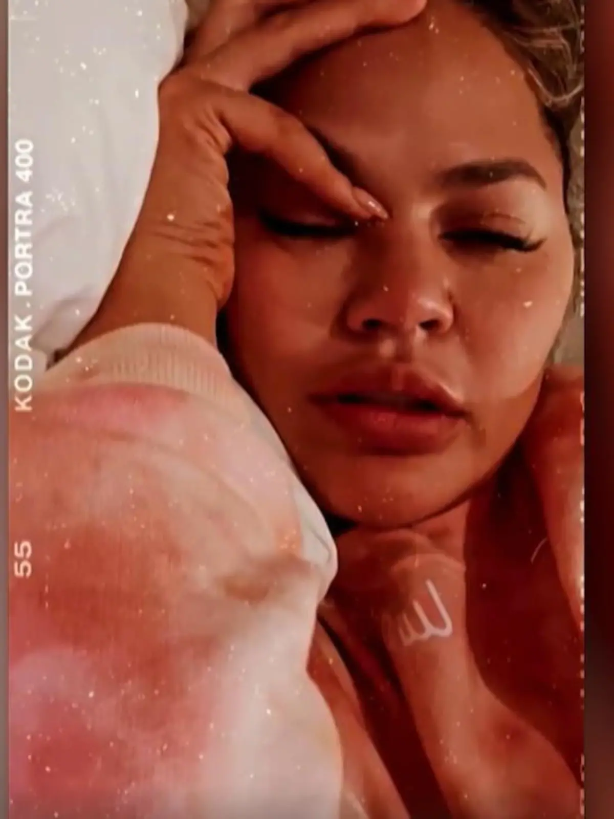 Bild zu: "Chrissy Teigen erholt sich von Endometriose-OP"
