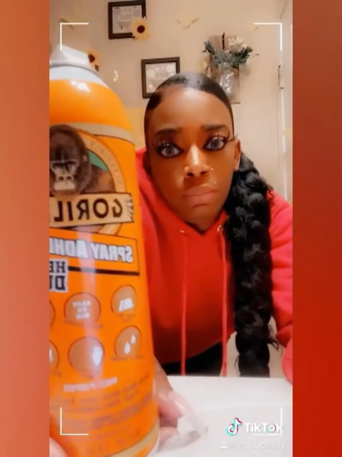 Bild zu: "Sekundenkleber als Haarspray benutzt"