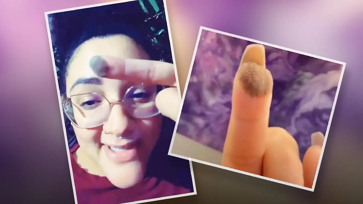 Fingerkuppe mit Haaren
