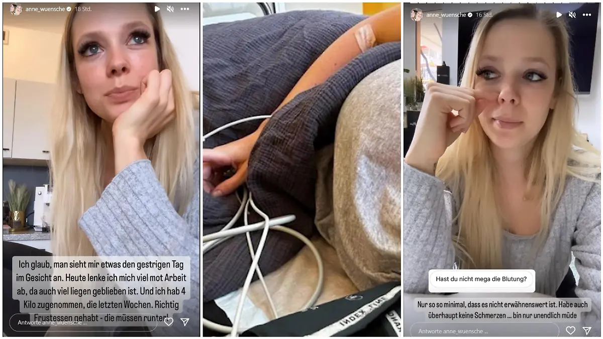 Anne Wünsche gibt auf Instagram ein Update nach ihrer Abtreibung.