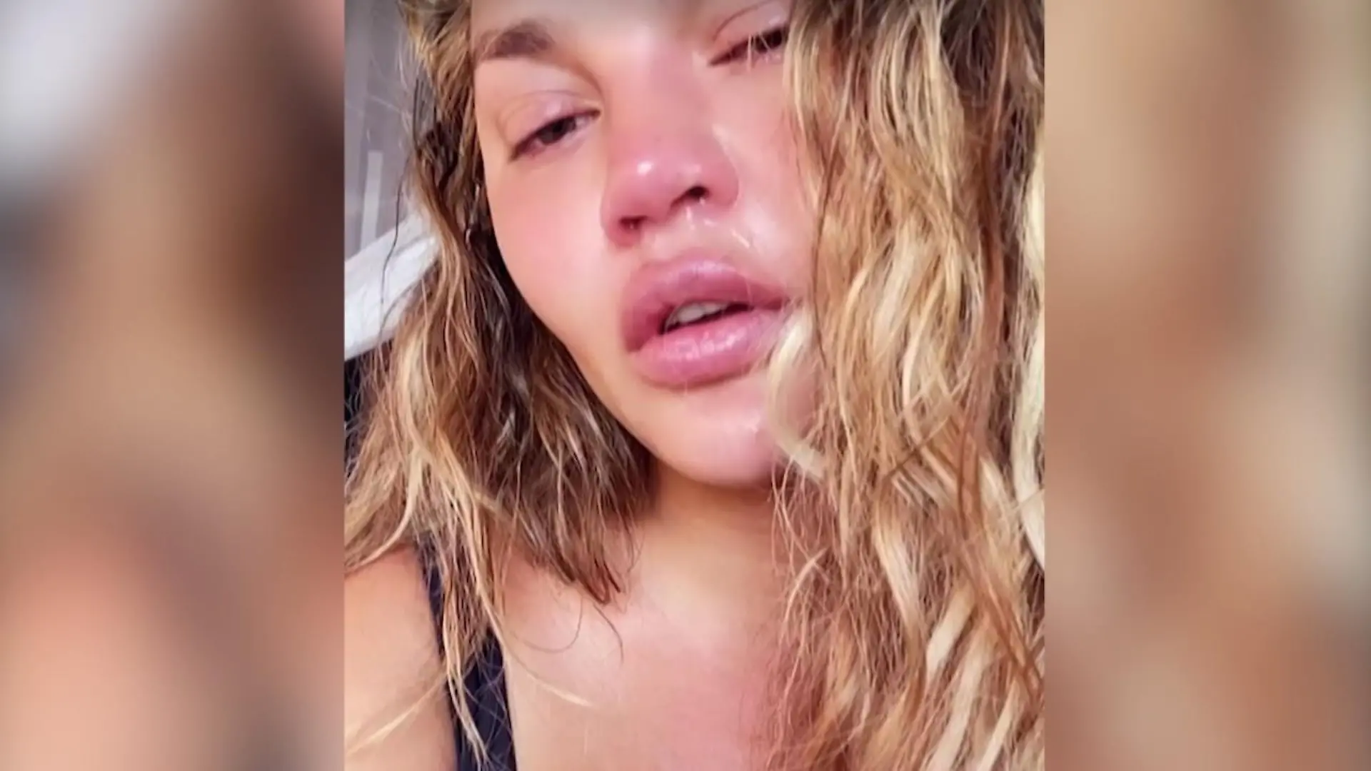 Chrissy Teigen trauert um ihr verlorenes Kind Verheult nach der Therapie