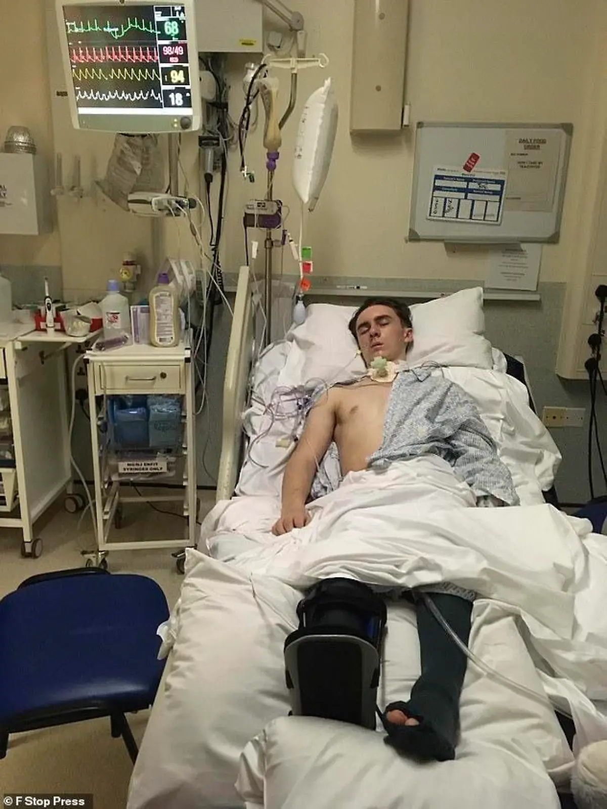 Joseph Flavill an diverse Geräte angeschlossen im Krankenhaus. Mittlerweile ist er aus dem Koma erwacht.