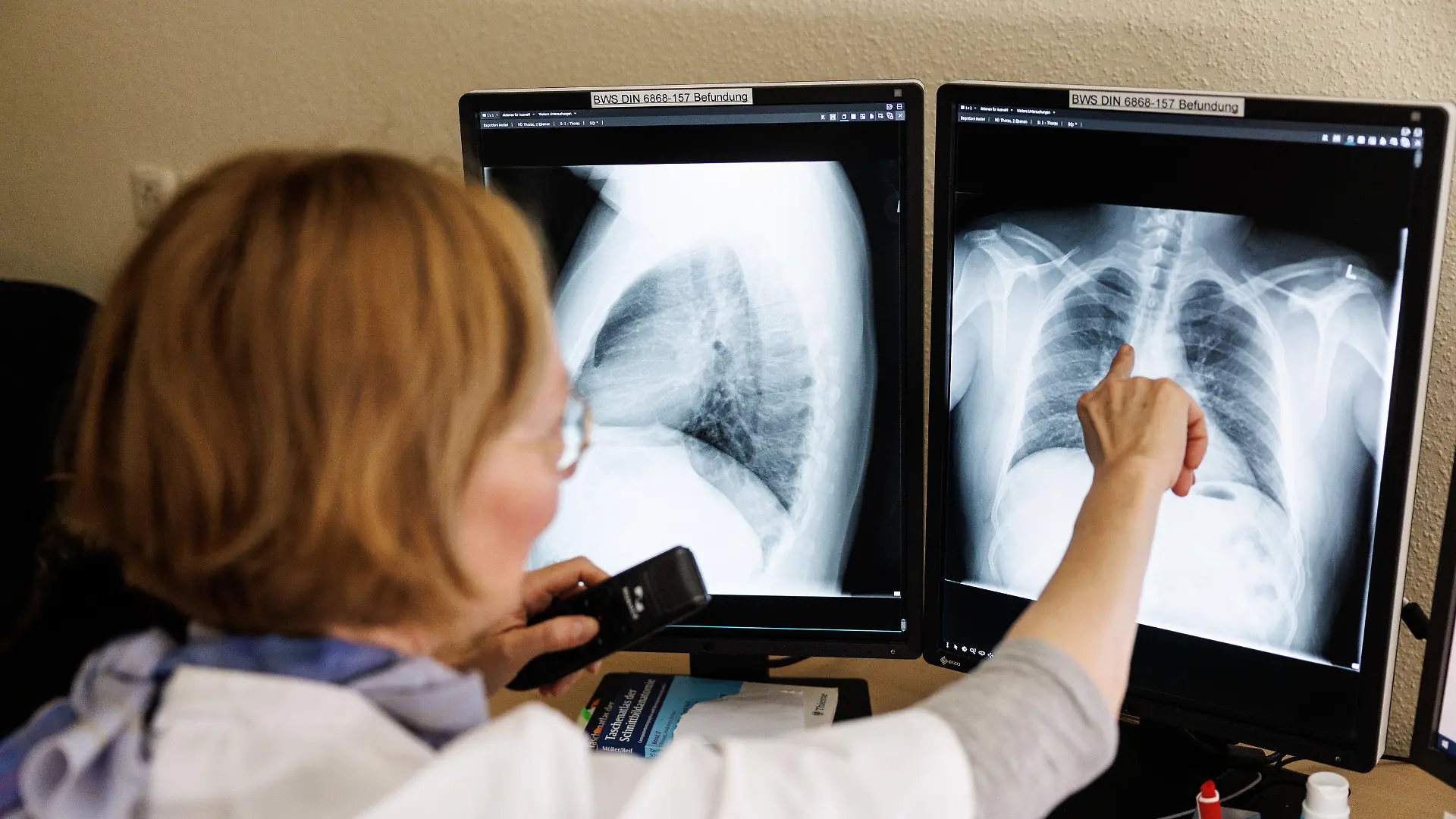 ARCHIV - 12.03.2022, Bayern, Gauting: Eine Radiologin analysiert in ihrem Büro in der Lungenklinik Gauting die Röntgenbilder der Lunge einer aus der Ukraine geflüchteten Person. Nach längerer rückläufiger Entwicklung ist die Zahl der gemeldeten Tuberkulose-Fälle (TB) in Deutschland im vergangenen Jahr auf niedrigem Niveau leicht angestiegen - wohl auch eine Folge des russischen Angriffskriegs in der Ukraine. (zu dpa «Tuberkulose-Fallzahlen in Deutschland leicht gestiegen») Foto: Matthias Balk/dpa +++ dpa-Bildfunk +++