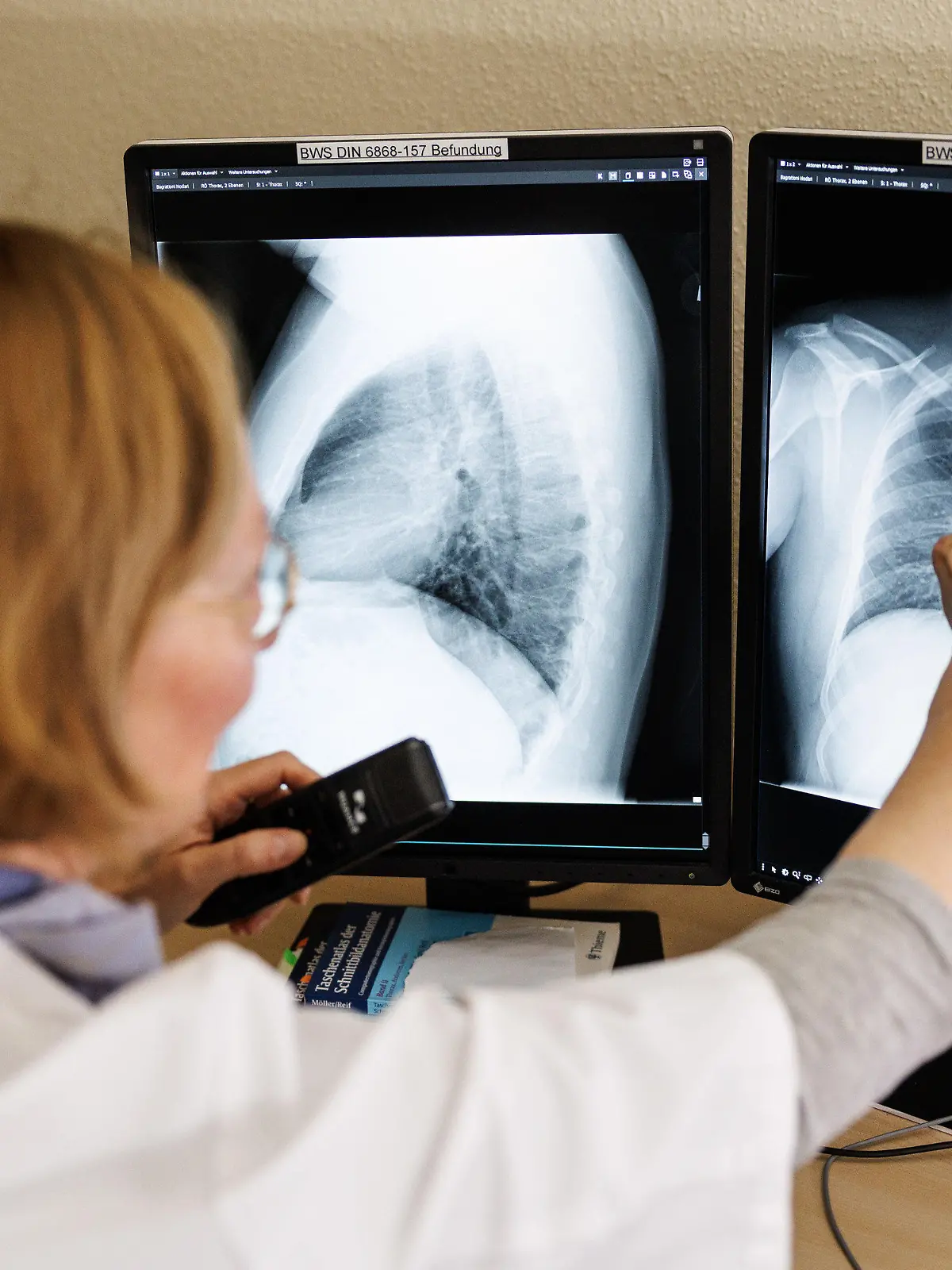 ARCHIV - 12.03.2022, Bayern, Gauting: Eine Radiologin analysiert in ihrem Büro in der Lungenklinik Gauting die Röntgenbilder der Lunge einer aus der Ukraine geflüchteten Person. Nach längerer rückläufiger Entwicklung ist die Zahl der gemeldeten Tuberkulose-Fälle (TB) in Deutschland im vergangenen Jahr auf niedrigem Niveau leicht angestiegen - wohl auch eine Folge des russischen Angriffskriegs in der Ukraine. (zu dpa «Tuberkulose-Fallzahlen in Deutschland leicht gestiegen») Foto: Matthias Balk/dpa +++ dpa-Bildfunk +++