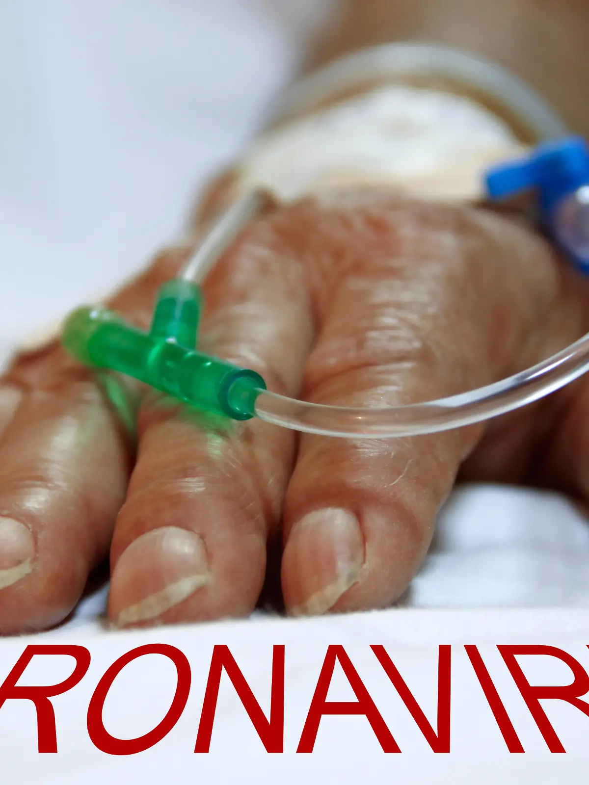 Coronavirus Tote Krankenhaus Hand