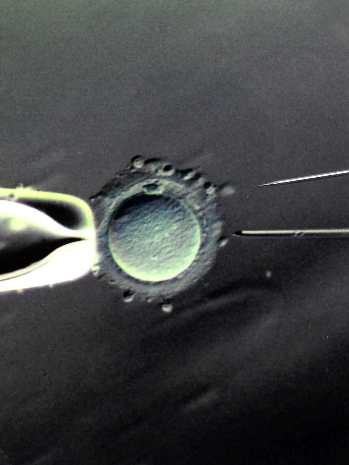 ARCHIV - Im Biologischen Labor des Zentrums für Reproduktionsmedizin an der Universitätsfrauenklinik in Leipzig ist eine 80- bis 100-fache Vergrößerung der Befruchtung einer Eizelle mit einer Injektionspipette und eine darüber liegende Injektionspipette mit einem Durchmessser von 5 Mikrometer in Originalgröße zu sehen, aufgenommen am 17.03.2011. Sachsen-Anhalt und der Bund geben ungewollt kinderlosen Paaren künftig mehr Geld für künstliche Befruchtungen dazu. Foto: Waltraud Grubitzsch/dpa (zu dpa «Stärkere finanzielle Unterstützung bei künstlichen Befruchtungen» vom 10.02.2014) +++(c) dpa - Bildfunk+++