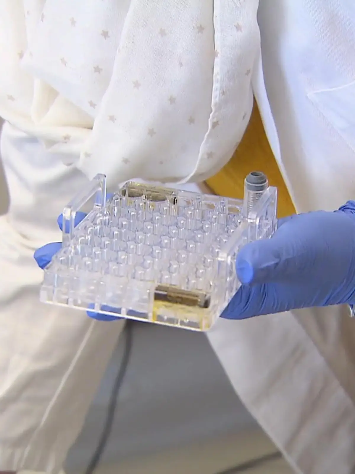 Infiziert sich eine Person mit dem Coronavirus, ist zunächst nicht abzuschätzen, wie schwer die Erkrankung verlaufen wird und ob die Betroffenen letztendlich sogar auf der Intensivstation behandelt werden müssen. Ein Urintest, der nun eine Sonderzulassung erhielt, soll das ändern: Er soll mit hoher statistischer Genauigkeit ermöglichen, den Verlauf von Covid-19 schon zu Beginn vorauszusagen. Wie das genau funktioniert, sehen Sie im Video.