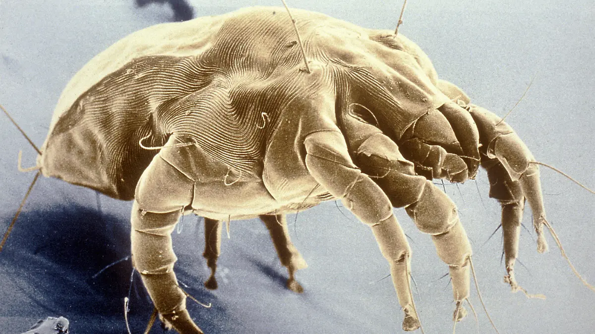 Vieltausendfach vergrößerte, undatierte Mikroskop-Aufnahme einer Hausstaubmilbe (lat.: Dermatophagoides pteronyssinus). Milben, von denen inzwischen über 30000 Arten bekannt sind, leben vor allem im Hausstaub sowie in Matratzen, Polstermöbeln und Teppichen. Die winzigen Tiere ernähren sich von menschlichen Hautschuppen, Schimmelpilzen und Nahrungsresten. Milben gehören zu den wichtigsten Allergieauslösern in Innenräumen. Allergisch ausgelöste Krankheiten haben in den vergangenen 20 Jahren stark zugenommen: Inzwischen leidet jeder fünfte Deutsche an einer Allergie - das betrifft Erwachsene wie Kinder.