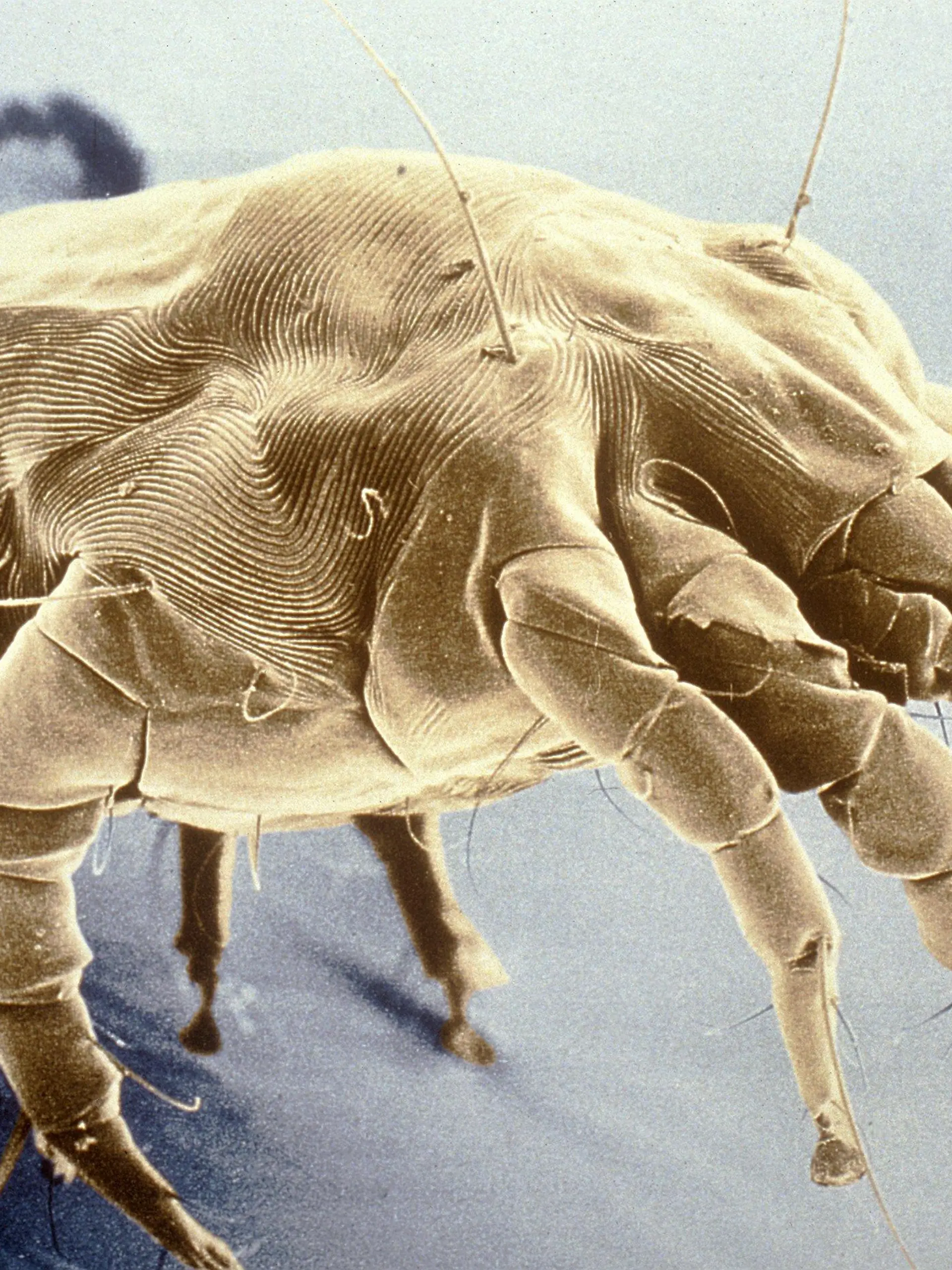 Vieltausendfach vergrößerte, undatierte Mikroskop-Aufnahme einer Hausstaubmilbe (lat.: Dermatophagoides pteronyssinus). Milben, von denen inzwischen über 30000 Arten bekannt sind, leben vor allem im Hausstaub sowie in Matratzen, Polstermöbeln und Teppichen. Die winzigen Tiere ernähren sich von menschlichen Hautschuppen, Schimmelpilzen und Nahrungsresten. Milben gehören zu den wichtigsten Allergieauslösern in Innenräumen. Allergisch ausgelöste Krankheiten haben in den vergangenen 20 Jahren stark zugenommen: Inzwischen leidet jeder fünfte Deutsche an einer Allergie - das betrifft Erwachsene wie Kinder.