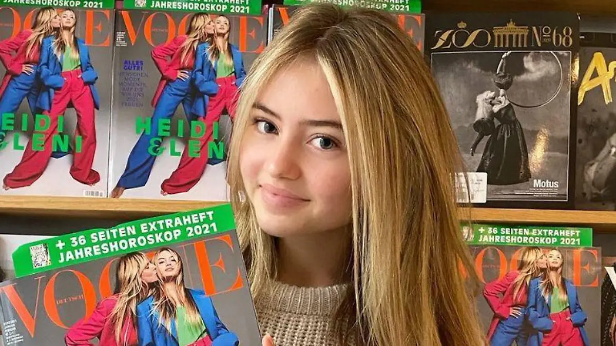 Keni Klum schmückte kürzlich die Vogue - ohne Pickel