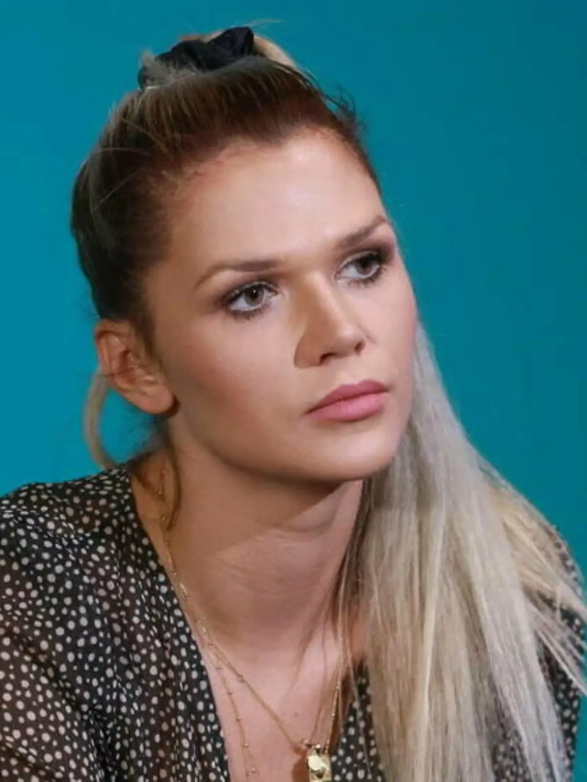 Model Sara Kulka spricht offen über ihre psychischen Probleme