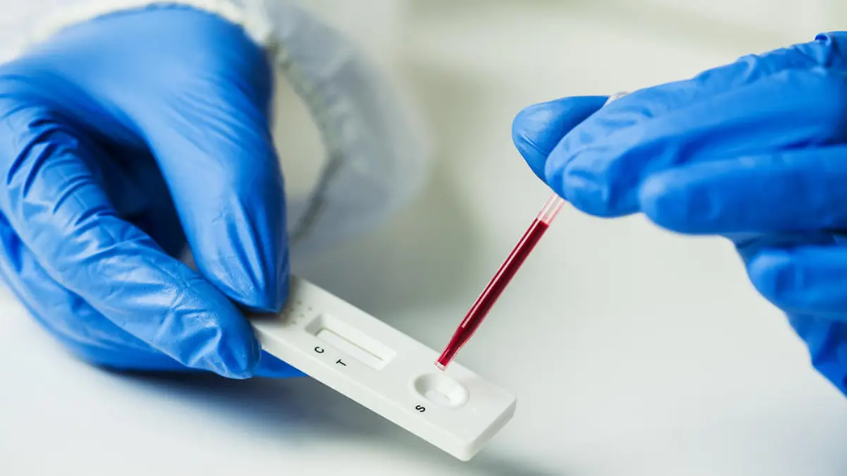 Antigen-Schnelltests vor dem Fest? Die Vor- und Nachteile im Überblick