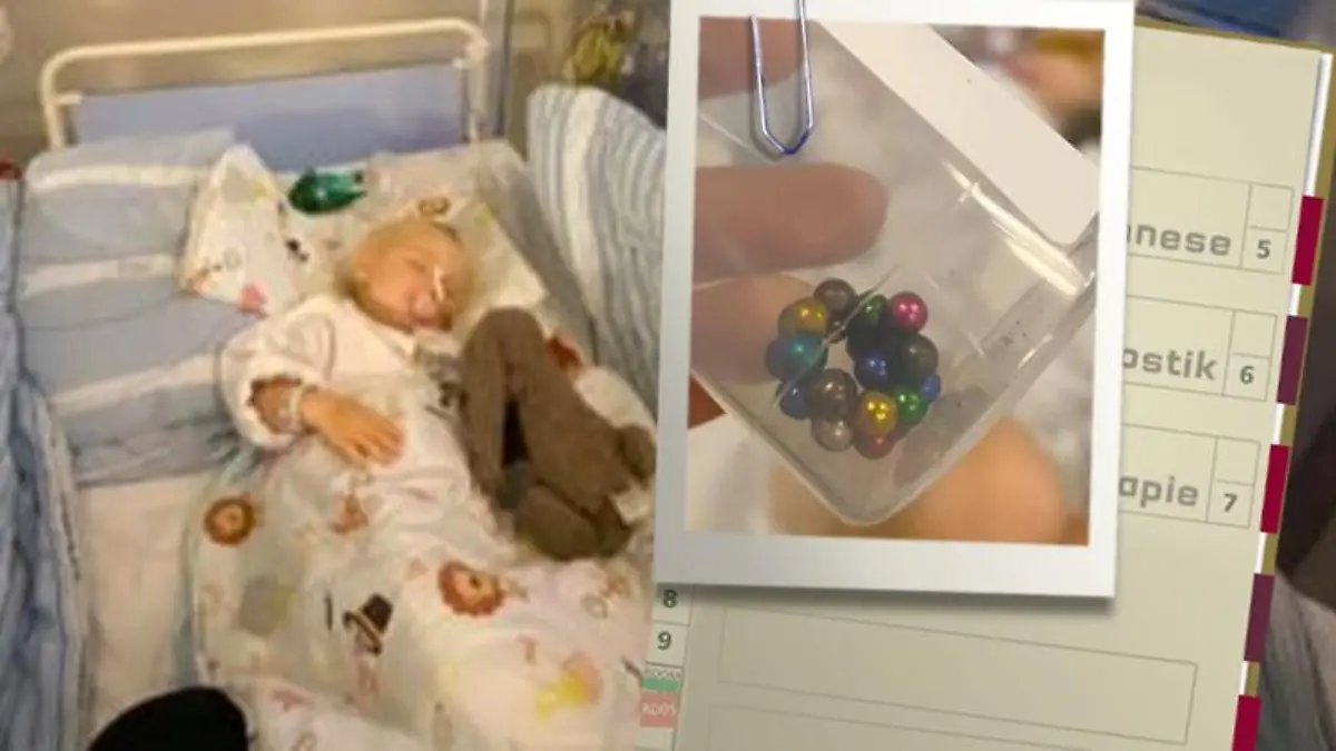 Die kleine Mille hatte 21 Magnet-Kügelchen runtergeschluckt.