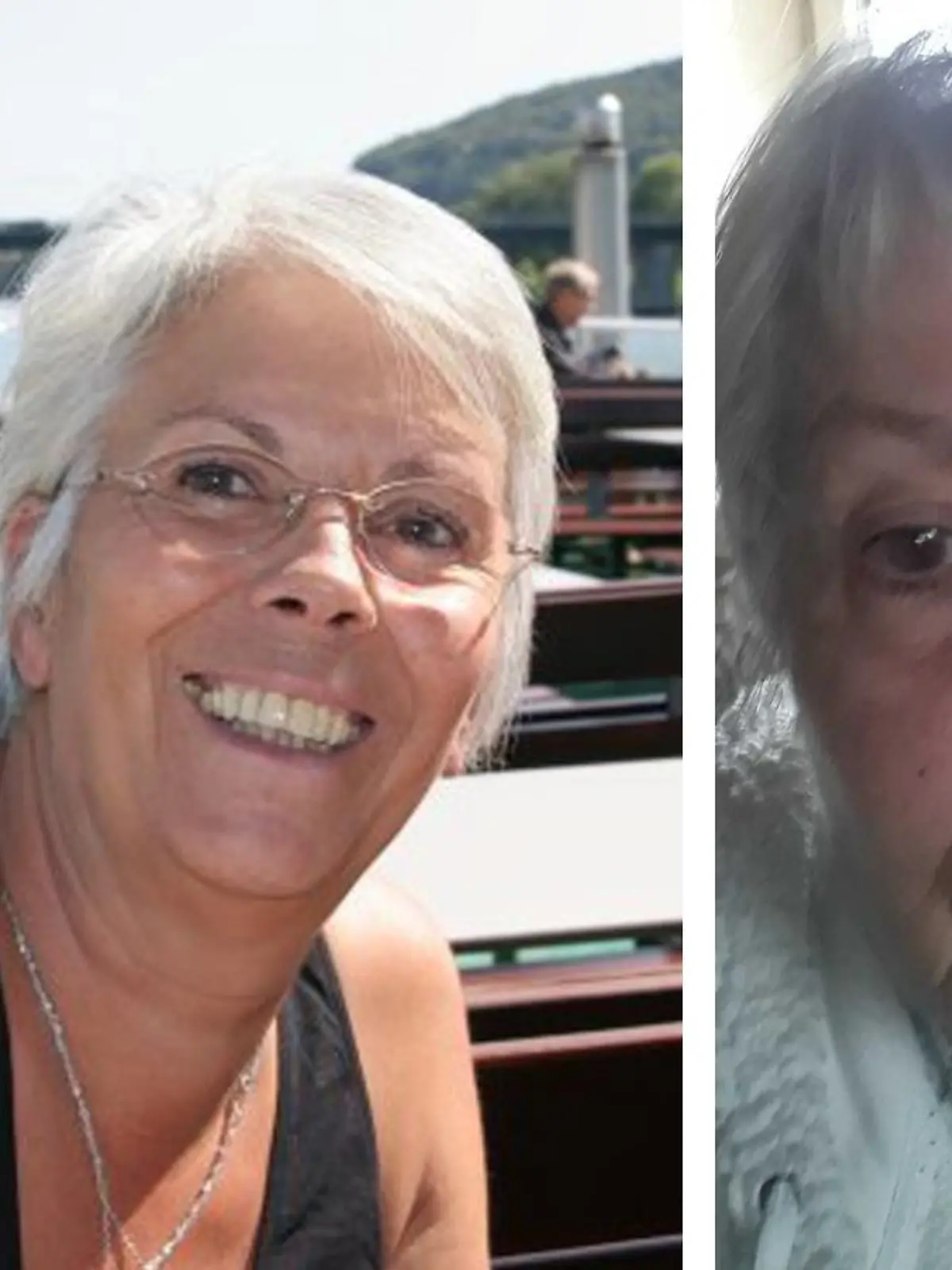Rechts sieht man Ulrike als gesunde strahlende Frau. Links sieht man sie mit einem Loch im Gesicht, dort, wo ihre Nase einmal gewesen ist.