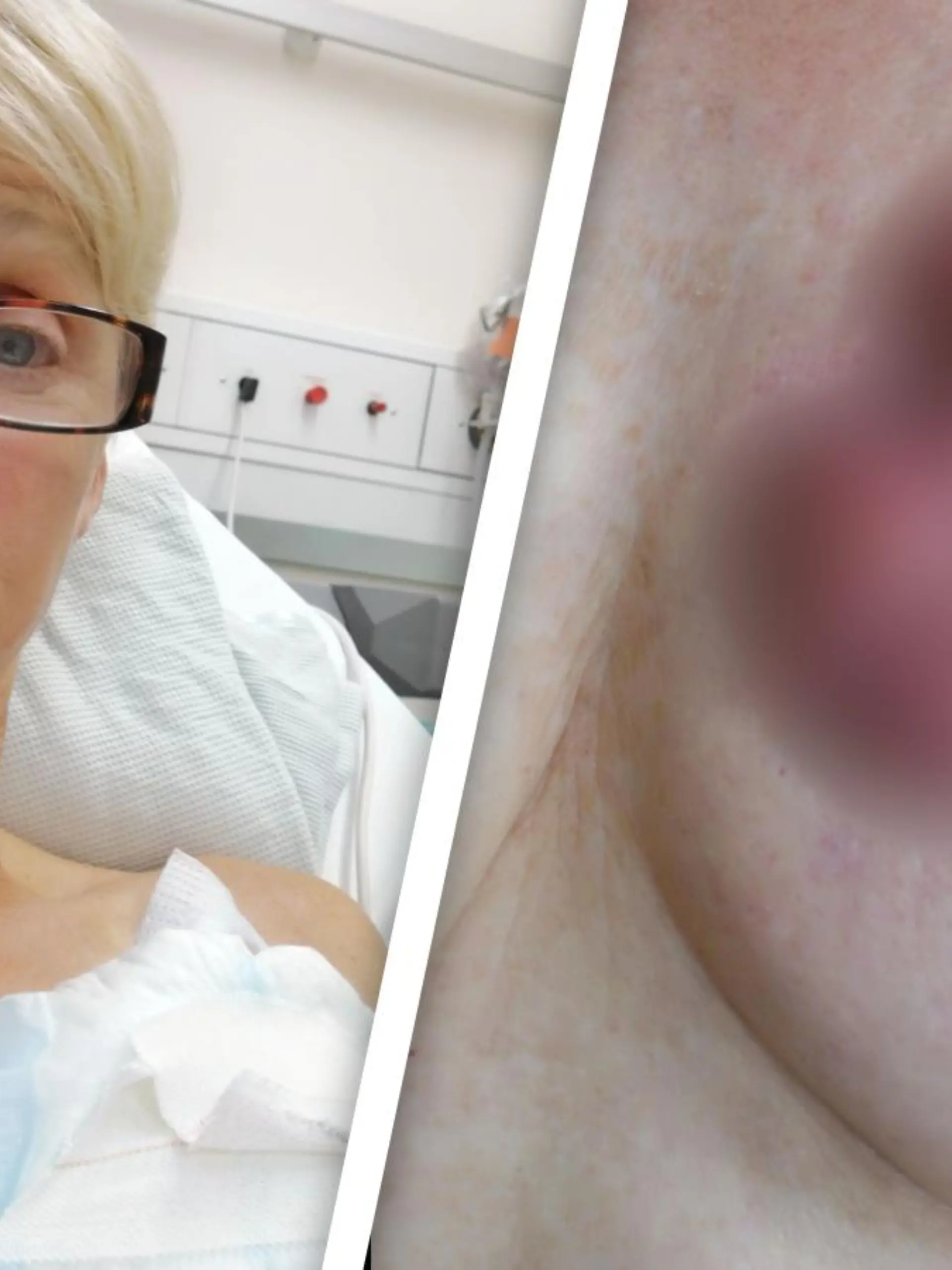 Frau mit unkenntlich gemachten Tumoren