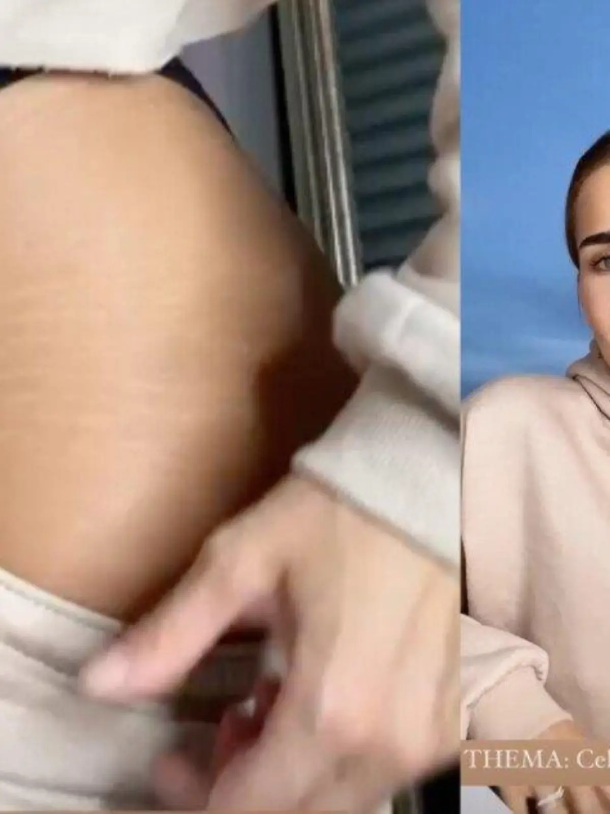 Anahita hat kein Problem damit ihre Dehnungsstreifen zu zeigen.