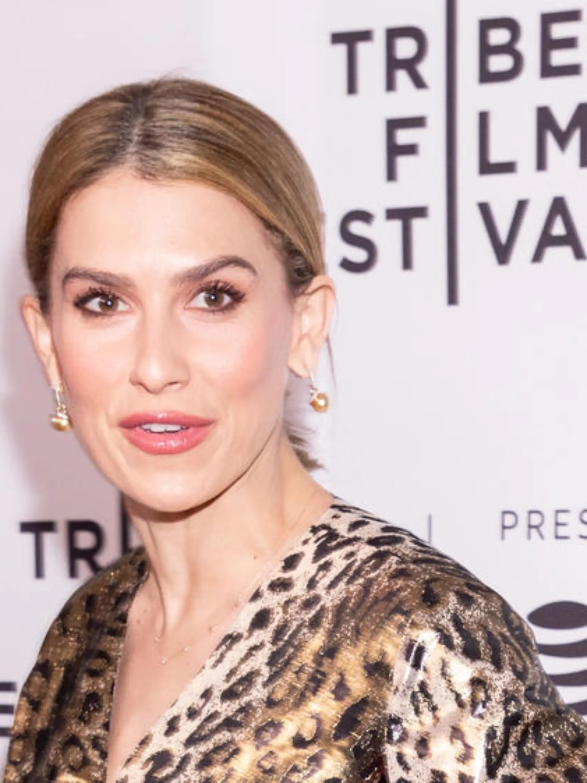 Hilaria Baldwin hat sich beim Joggen den Knöchel gebrochen