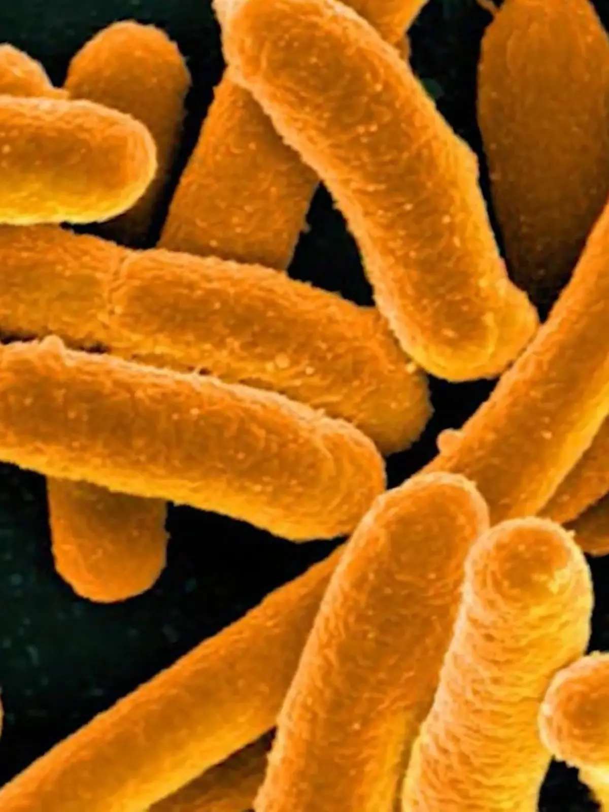Multiresistente Keime werden vor allem in Krankenhäusern häufig zu einem Problem. Doch auch beim Berühren von rohem Fleisch, oder Obst kann es zu einer Übertragung kommen.