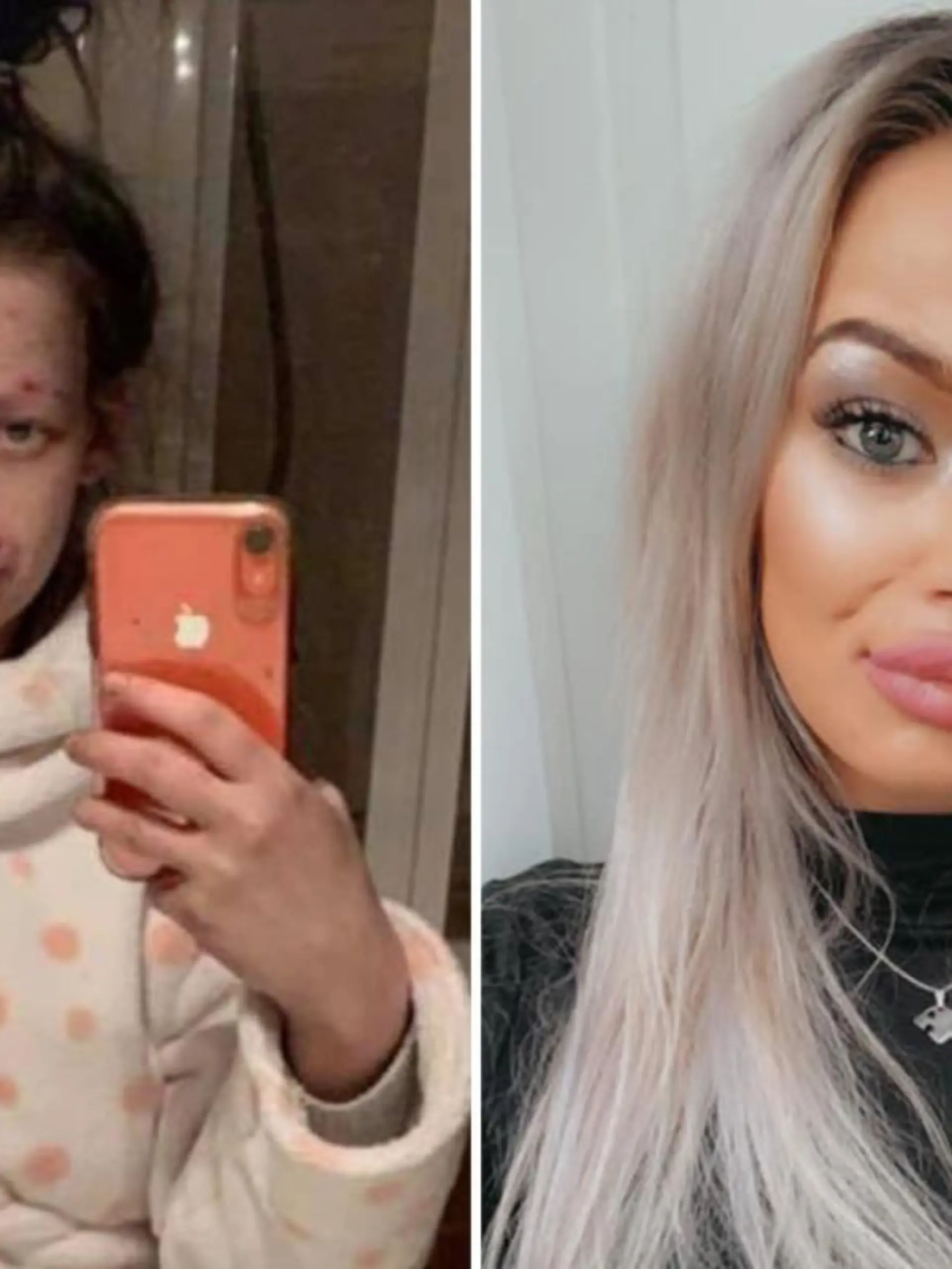 Zwei Jahre lang war Zweifach-Mama Demi-Nicole Dunlop aus dem schottischen Fochabers schwerst abhängig von Heroin und Crack. Die unglaublichen Bilder zeigen, wie gut sich die Studentin mittlerweile erholt hat.
