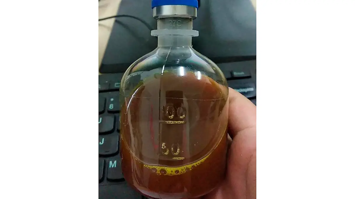 This August 2020, photo provided by a Uighur under quarantine shows a bottle of unidentified traditional Chinese medicine in Urumqi, China. As parts of the Xinjiang region in China's far northwest enters the 45th day of a second grueling lockdown due to a coronavirus outbreak, the government there is coercing some residents into using traditional Chinese medicine despite a lack of rigorous clinical data proving it works. (AP Photo)