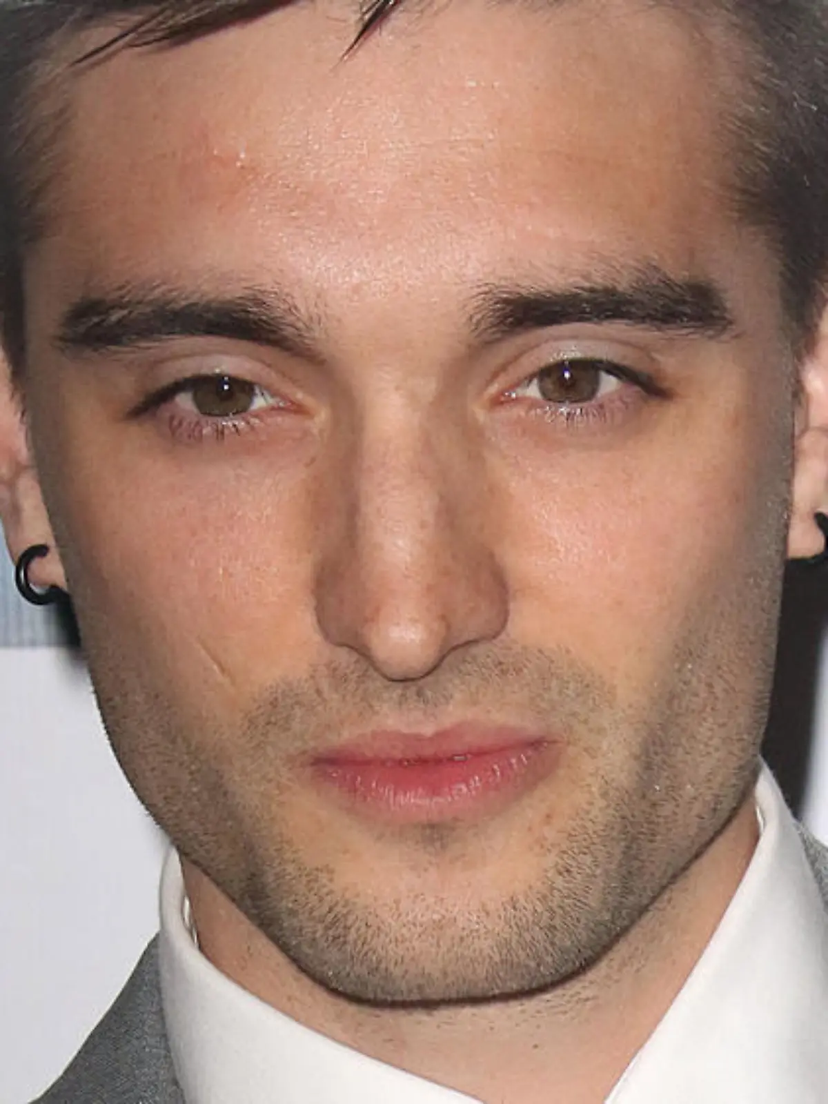 The-Wanted-Sänger Tom Parker leidet an einem Hirntumor