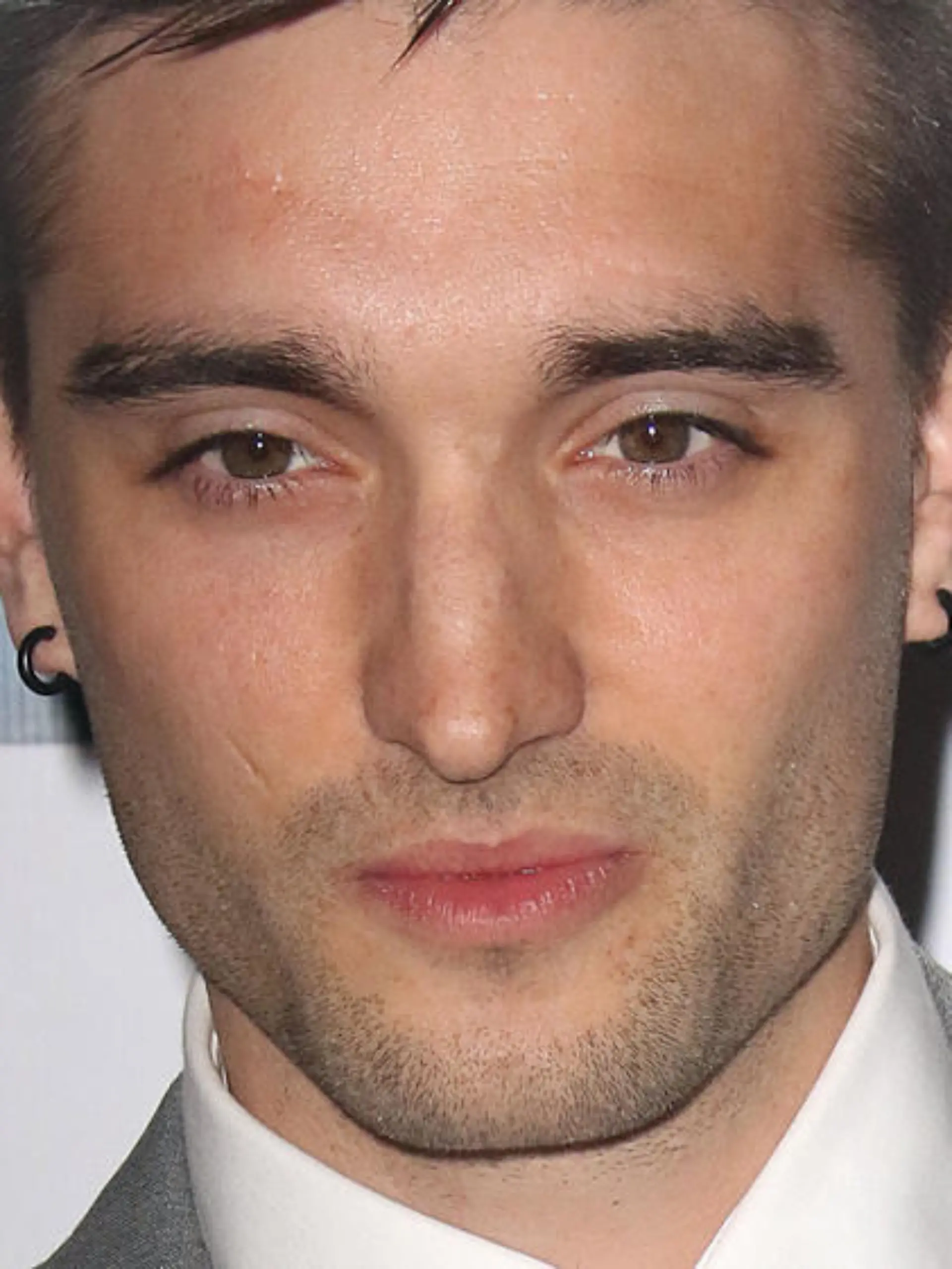 The-Wanted-Sänger Tom Parker leidet an einem Hirntumor