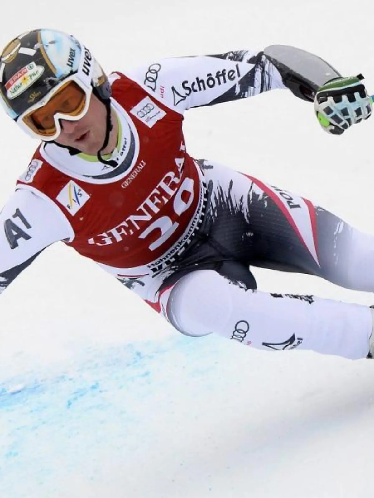 Bei Hannes Reichelt wurde ein schwerer Bandscheibenvorfall diagnostiziert. Foto: Robert Jaeger