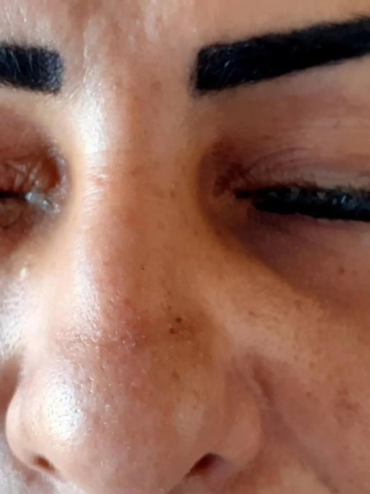 Frau geriet Wimpernkleber in die Augen