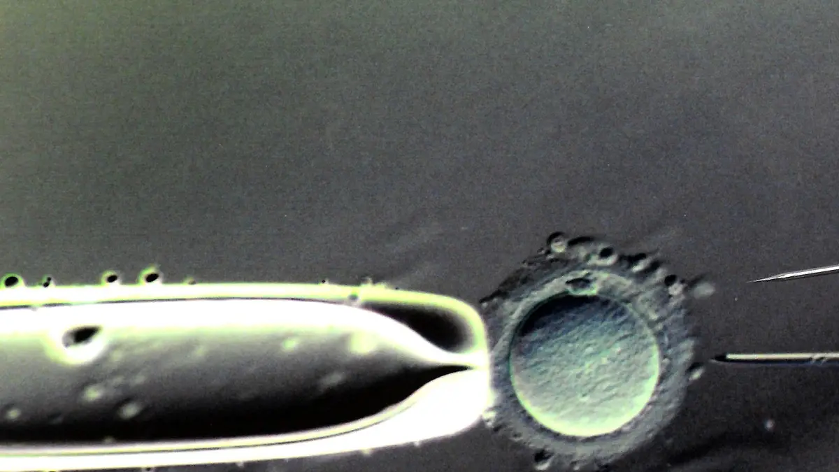 ARCHIV - Im Biologischen Labor des Zentrums für Reproduktionsmedizin an der Universitätsfrauenklinik in Leipzig ist eine 80- bis 100-fache Vergrößerung der Befruchtung einer Eizelle mit einer Injektionspipette und eine darüber liegende Injektionspipette mit einem Durchmessser von 5 Mikrometer in Originalgröße zu sehen, aufgenommen am 17.03.2011.    (zu dpa «Mediziner: Eizellspende muss in Deutschland erlaubt werden» vom 31.03.2017) Foto: Waltraud Grubitzsch/dpa-Zentralbild/dpa +++(c) dpa - Bildfunk+++