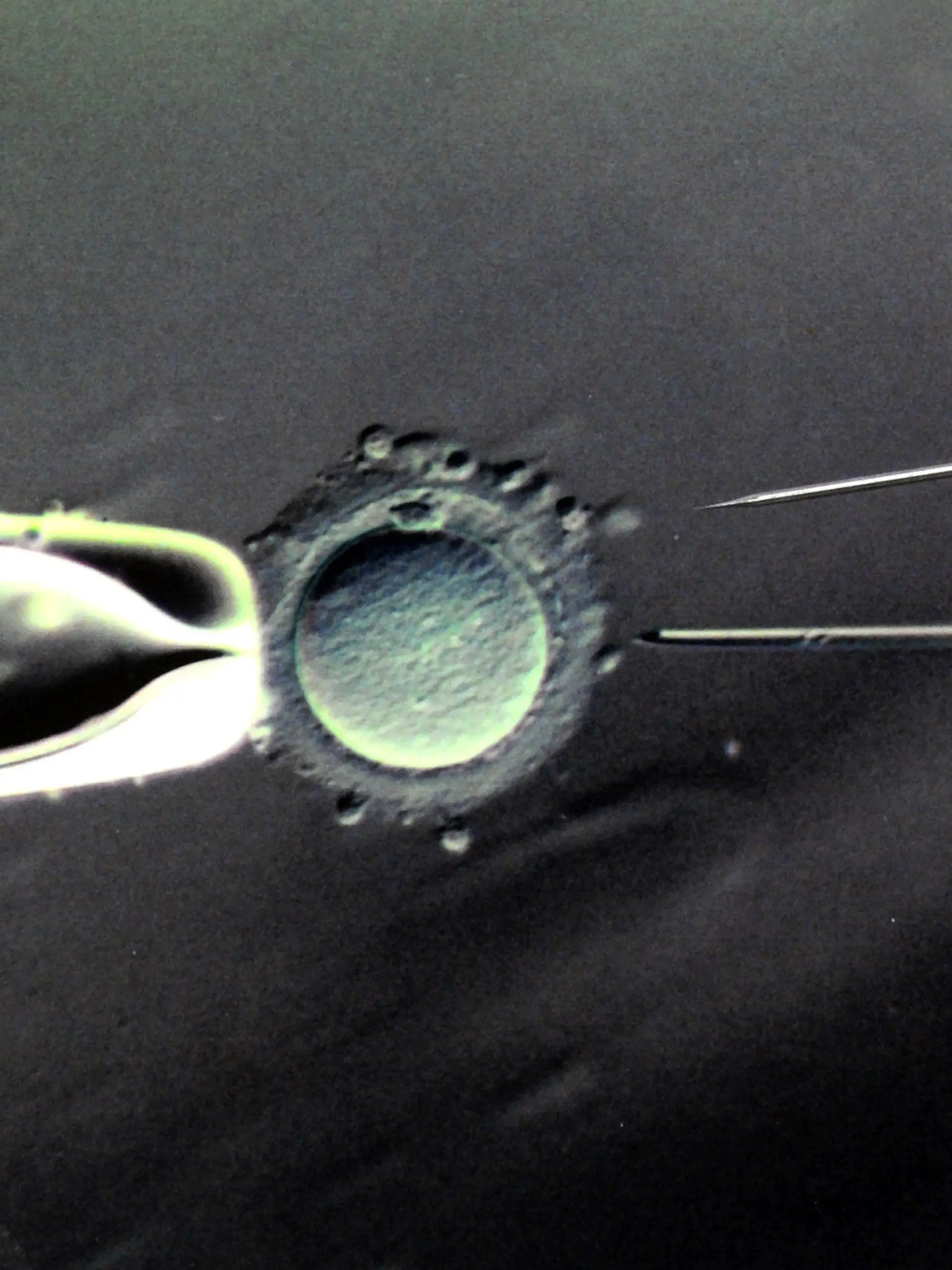 ARCHIV - Im Biologischen Labor des Zentrums für Reproduktionsmedizin an der Universitätsfrauenklinik in Leipzig ist eine 80- bis 100-fache Vergrößerung der Befruchtung einer Eizelle mit einer Injektionspipette und eine darüber liegende Injektionspipette mit einem Durchmessser von 5 Mikrometer in Originalgröße zu sehen, aufgenommen am 17.03.2011.    (zu dpa «Mediziner: Eizellspende muss in Deutschland erlaubt werden» vom 31.03.2017) Foto: Waltraud Grubitzsch/dpa-Zentralbild/dpa +++(c) dpa - Bildfunk+++