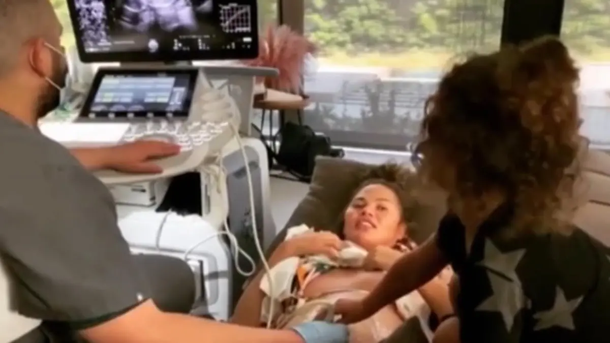 Ultraschalluntersuchung von Chrissy Teigen So süß: