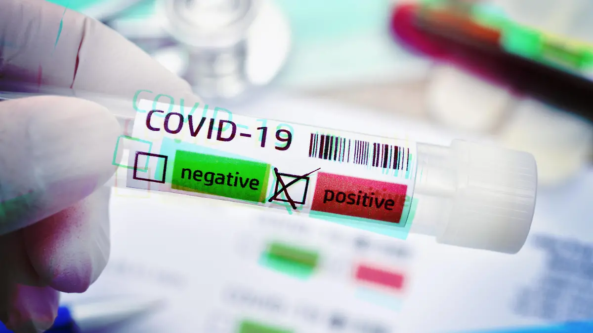 Abstrich-Röhrchen mit positivem Covid-19-Befund, Symbolfoto Coronavirus *** Swab tubes with positive Covid 19 result, symbol photo coronavirus