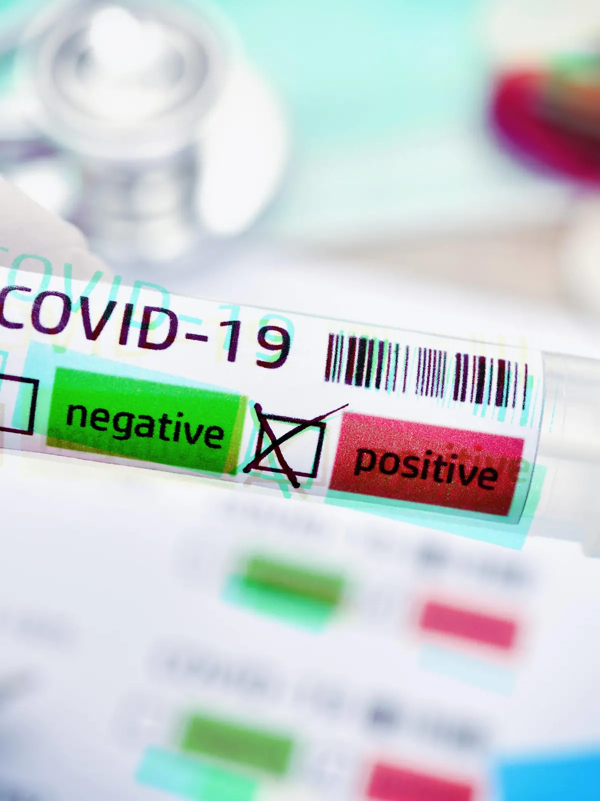 Abstrich-Röhrchen mit positivem Covid-19-Befund, Symbolfoto Coronavirus *** Swab tubes with positive Covid 19 result, symbol photo coronavirus 
