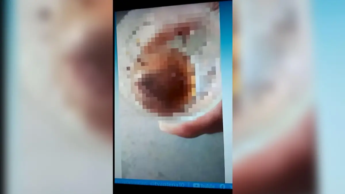 Nach der Beiß-Attacke konnten die Ärzte den Hoden nicht mehr anbringen.