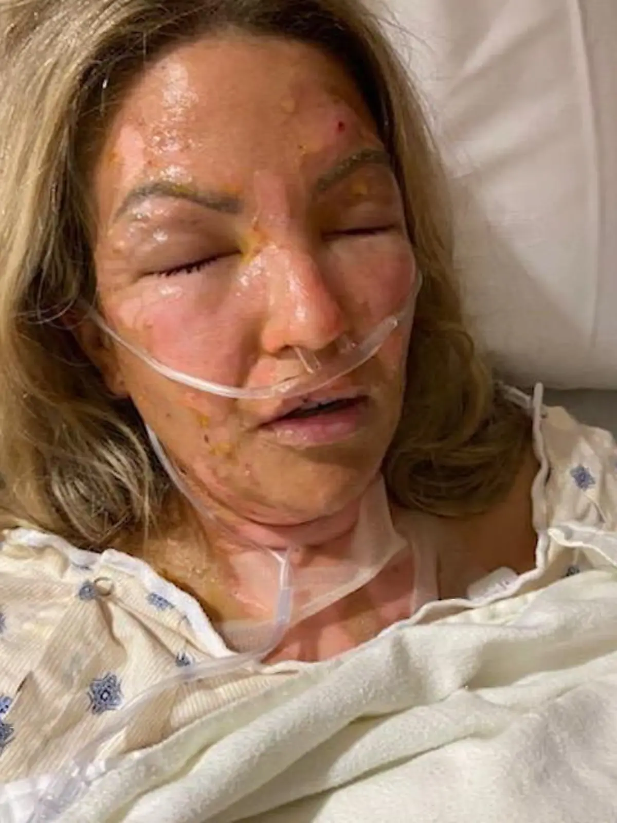 In Corona-Zeiten ist es zur Gewohnheit geworden, noch genauer auf Hand-Hygiene zu achten. Kate Wise aus Texas (USA) wurde diese Vorsichtsmaßnahme jetzt zum Verhängnis: Als sie mit frisch desinfizierten Händen ein Räucherstäbchen anzündete, erlitt sie schwere Verbrennungen. Im Video erzählt sie, wie sie den schlimmen Unfall erlebte. Außerdem machen wir den Test: Wie gefährlich sind Desinfektionsmittel in Kombination mit Feuer?