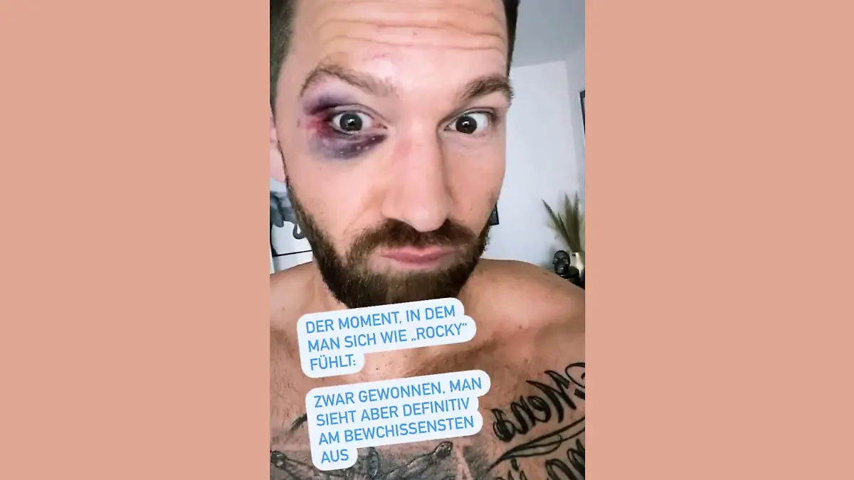 Oliver Sanne mit blauem Auge