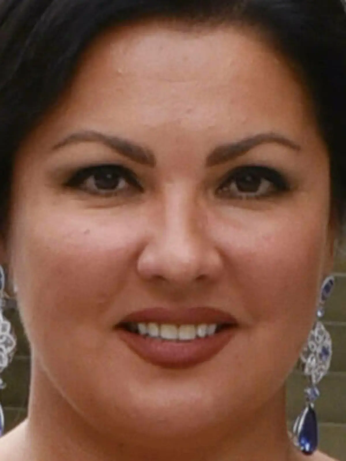 Anna Netrebko liegt mit Covid-19 im Krankenhaus