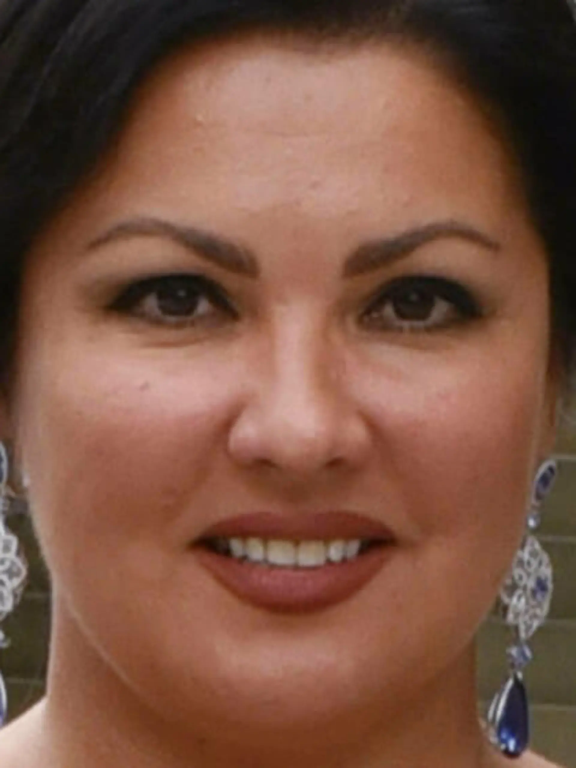Anna Netrebko liegt mit Covid-19 im Krankenhaus