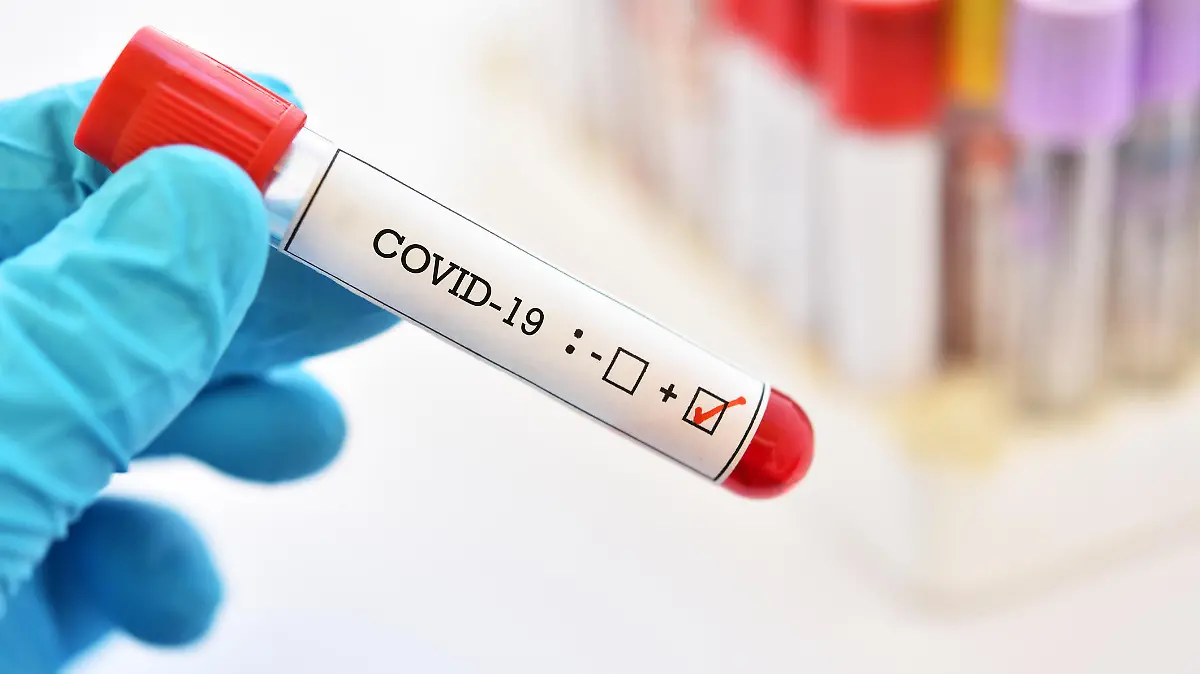 Wie aussagekräftig ist ein positiver Coronatest?