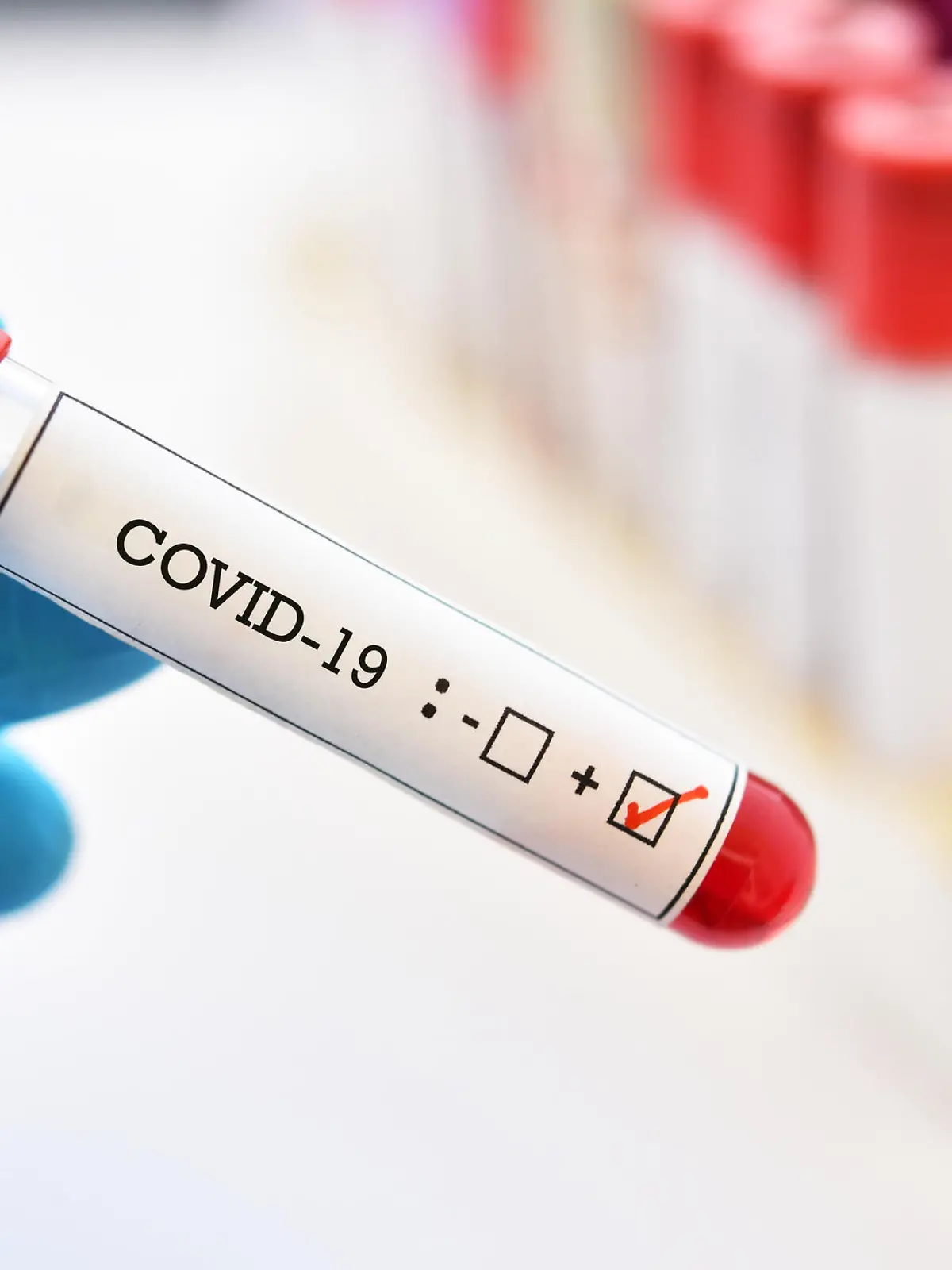 Wie aussagekräftig ist ein positiver Coronatest?