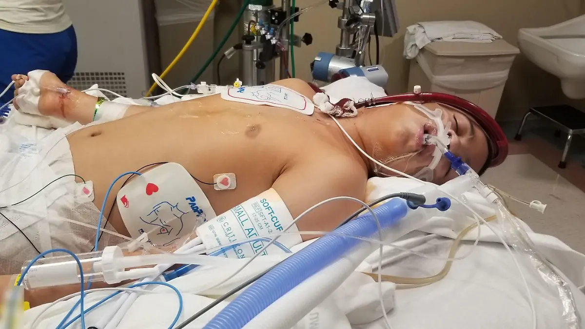 PIC FROM Kennedy News/Zachary Corona (PICTURED: ZACH CORONA, 13, ON LIFE SUPPORT) A mum claims her 'straight-A' schoolboy son has been left brain damaged after bullies forced him to smoke a vape - that turned out to be laced with deadly FENTANYL. Lynda Amos, from Dalton, Georgia, US, says son Zach Corona will 'never be the same again' as she claims the vape, which was hidden in his underwear, caused a stroke due to being laced with the drug, which is up to fifty times stronger than heroin. The mum-of-five, 45, was shocked upon discovering her 13-year-old boy passed out on their living room recliner at 6pm on 1st January after complaining of chest pains. DISCLAIMER: While Kennedy News and Media uses its best endeavours to establish the copyright and authenticity of all pictures supplied, it accepts no liability for any damage, loss or legal action caused by the use of images supplied and the publication of images is solely at your discretion. SEE KENNEDY NEWS COPY - 0161 697 4266