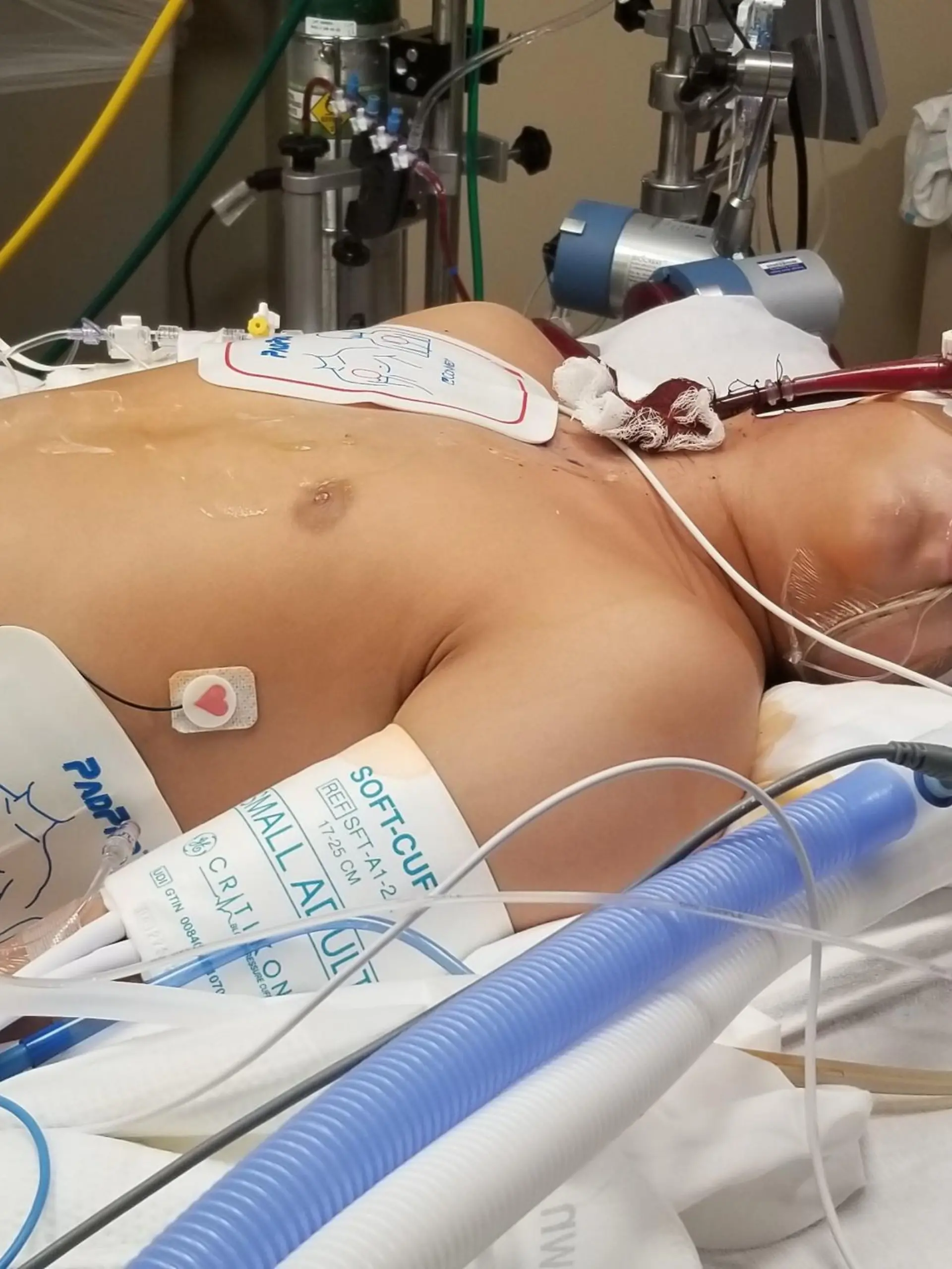 PIC FROM Kennedy News/Zachary Corona (PICTURED: ZACH CORONA, 13, ON LIFE SUPPORT) A mum claims her 'straight-A' schoolboy son has been left brain damaged after bullies forced him to smoke a vape - that turned out to be laced with deadly FENTANYL. Lynda Amos, from Dalton, Georgia, US, says son Zach Corona will 'never be the same again' as she claims the vape, which was hidden in his underwear, caused a stroke due to being laced with the drug, which is up to fifty times stronger than heroin. The mum-of-five, 45, was shocked upon discovering her 13-year-old boy passed out on their living room recliner at 6pm on 1st January after complaining of chest pains. DISCLAIMER: While Kennedy News and Media uses its best endeavours to establish the copyright and authenticity of all pictures supplied, it accepts no liability for any damage, loss or legal action caused by the use of images supplied and the publication of images is solely at your discretion. SEE KENNEDY NEWS COPY - 0161 697 4266