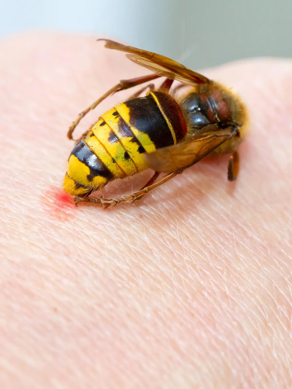 Hornet on a hand sting in the skin