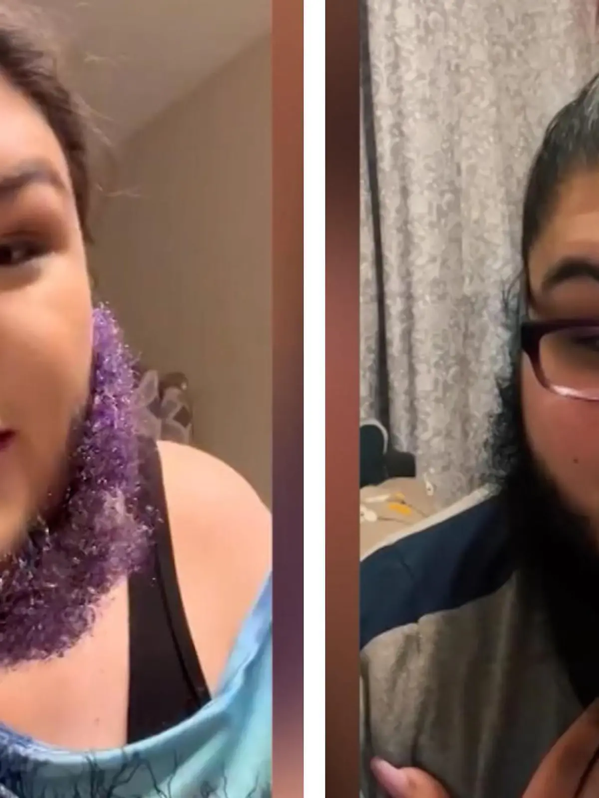 Coral Sanchez aus Seattle in den USA hat ein Erkennungsmerkmal, das einfach nicht zu übersehen ist und worauf sie immer wieder angesprochen wird: Die 29-Jährige hat einen Bart. Aber sie will ihn nicht länger verstecken. Nach 16 Jahren steht die 29-Jährige zu ihrem Haarwuchs im Gesicht und trägt den Bart jetzt mit Stolz.