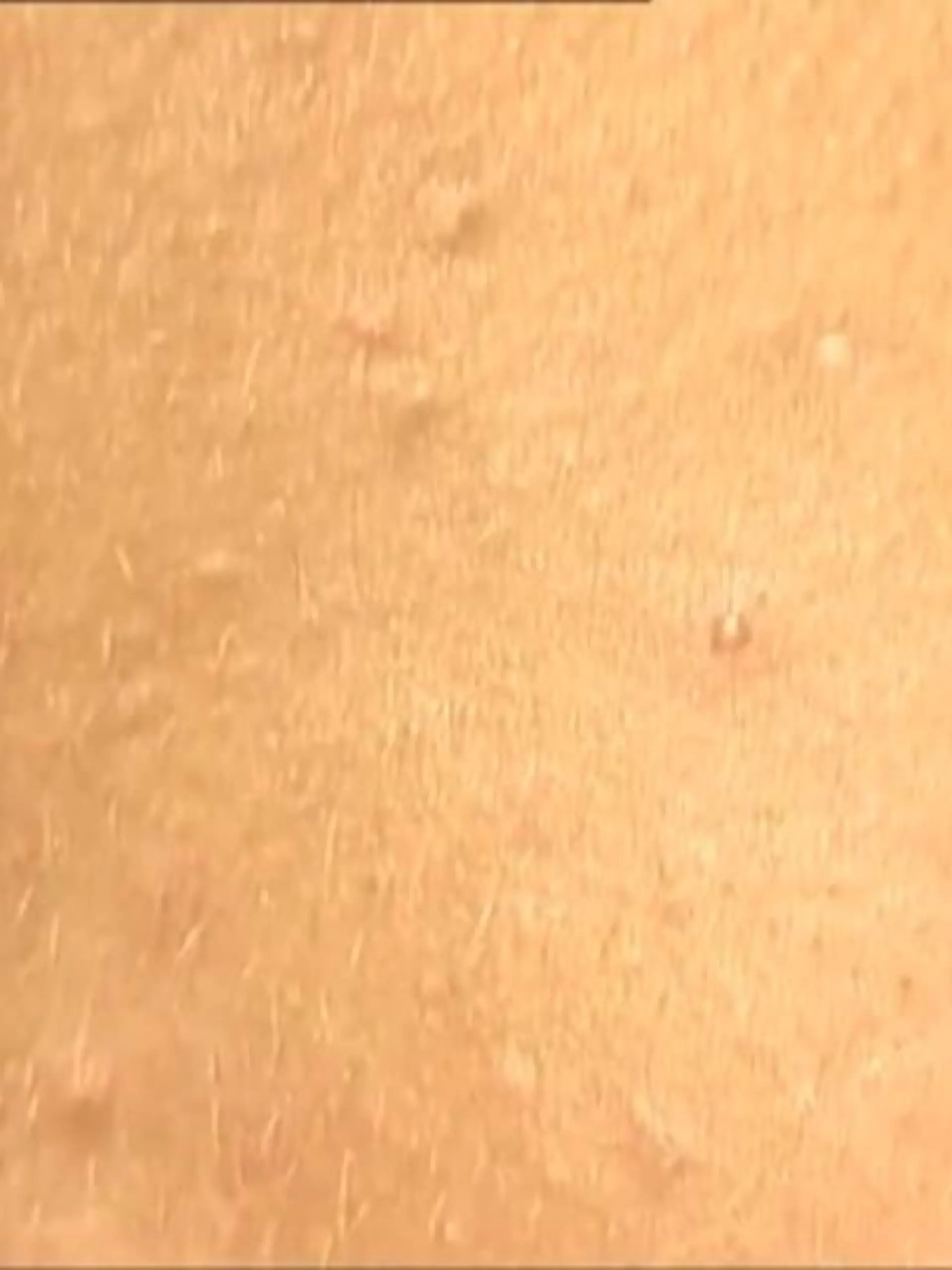 Bild zu: "Sonnenallergie: So kann man sich schützen"
