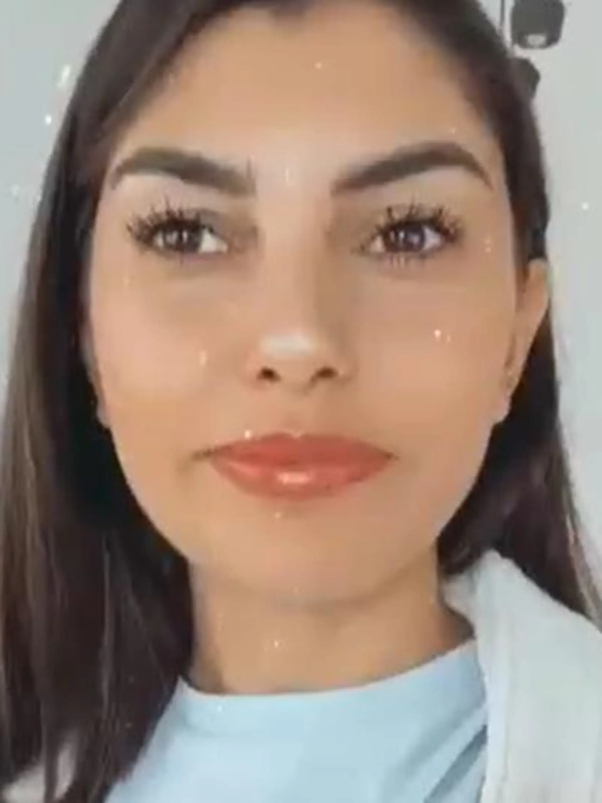 Yeliz Koc zeigt Ekel-Bilder ihrer Fuß-OP.